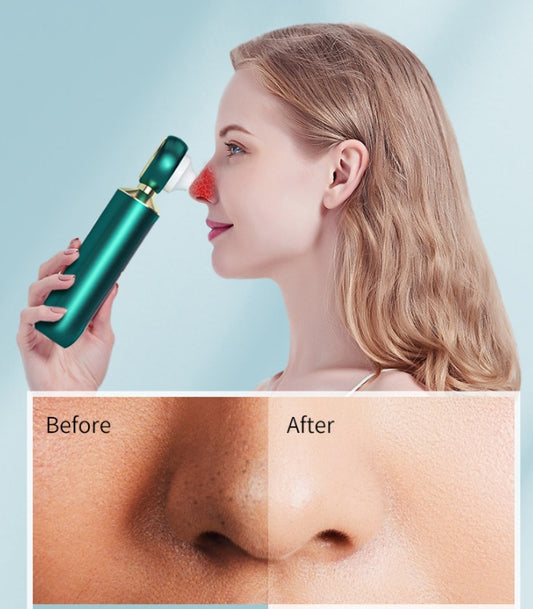 Woman using a green nasal device with 'Before' and 'After' skin comparisons on a light blue background.