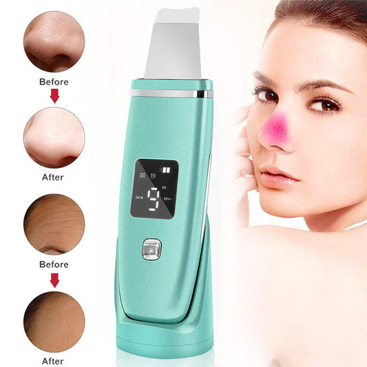 Ultrasonic Blackhead Remover - LED Facial Cleansing Device